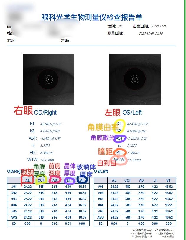 生物测量仪检查单 眼轴 (al) :成年人正常值24mm 角膜厚度( cct):低于