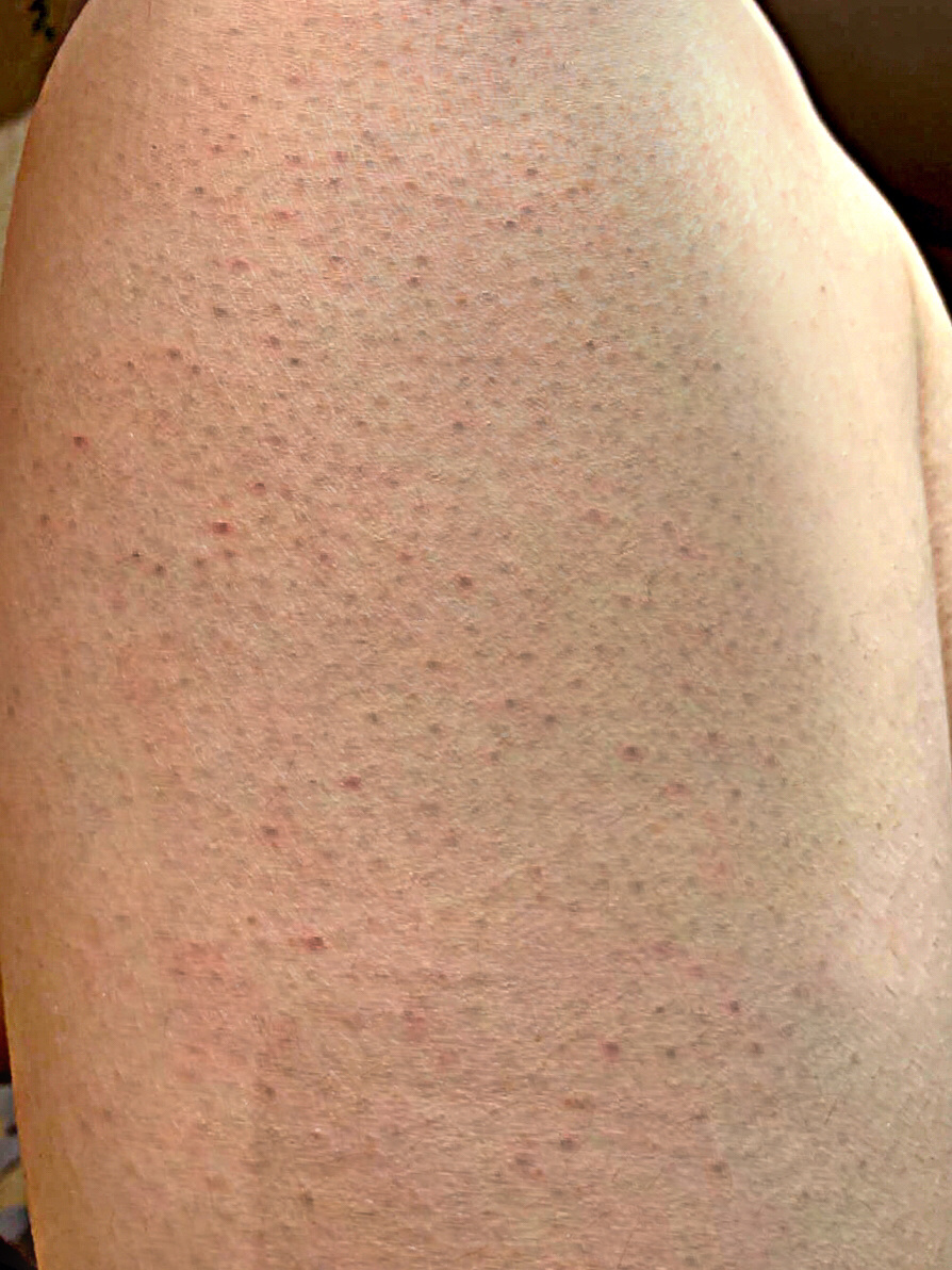 不删! 姐妹们,我试过了,这玩意去角质也太牛了吧!