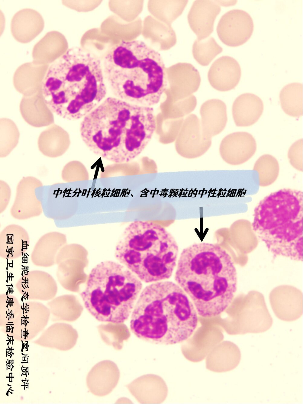 中性杆状核粒细胞图片