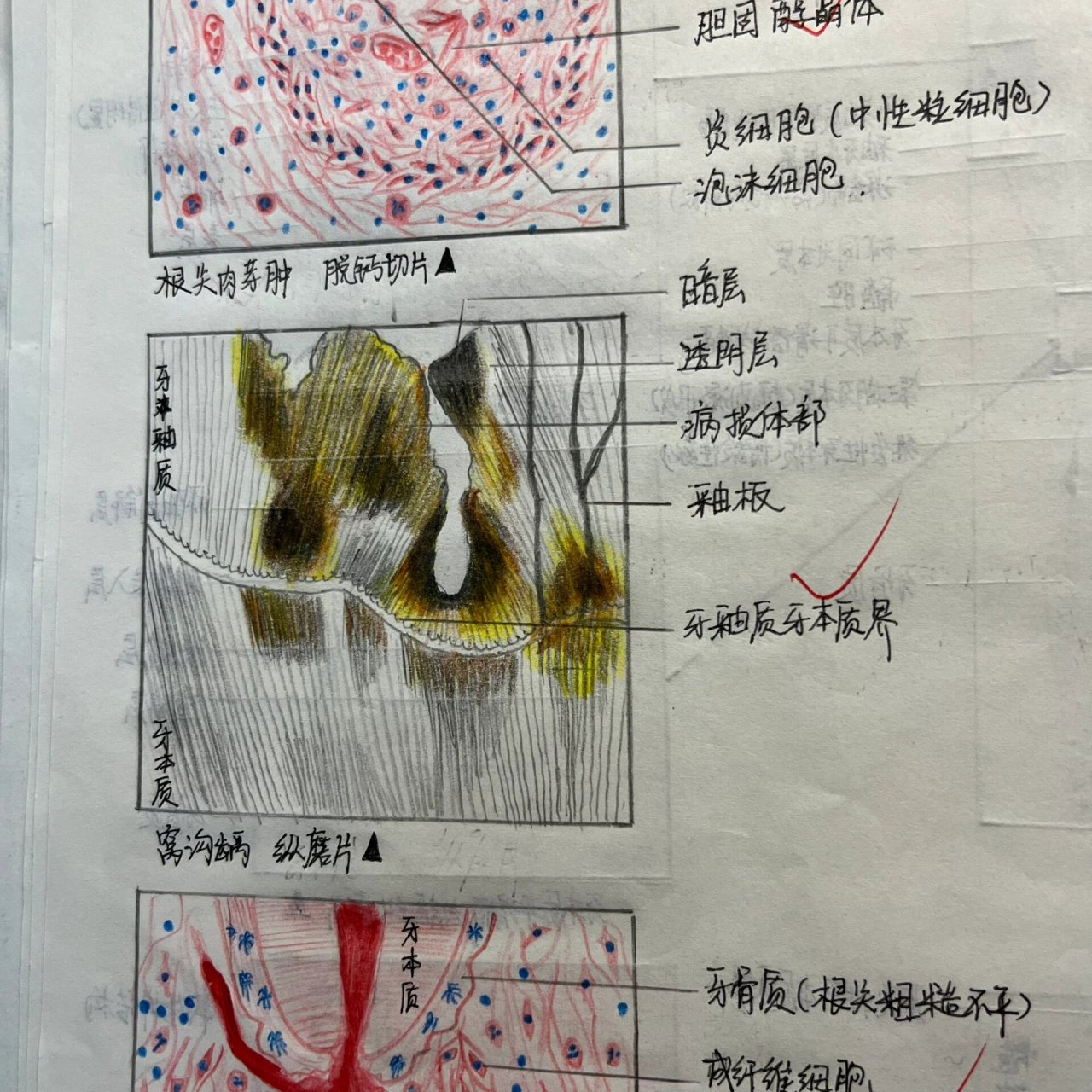 成牙本质细胞突图片