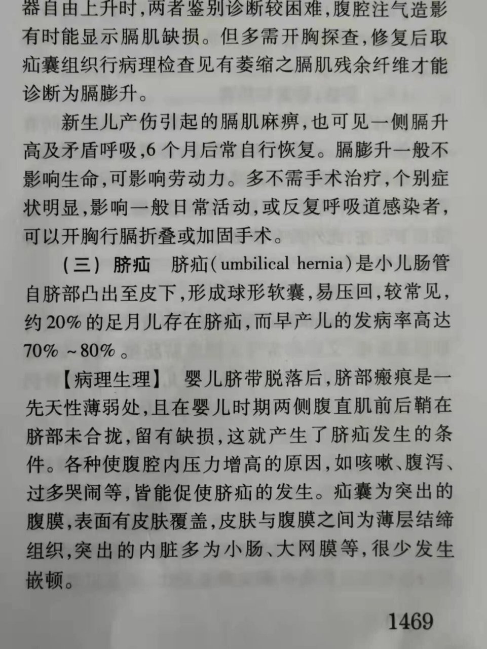 小儿脐疝的处理  01《诸福棠实用儿科学》讲到80%的小儿脐疝2岁内