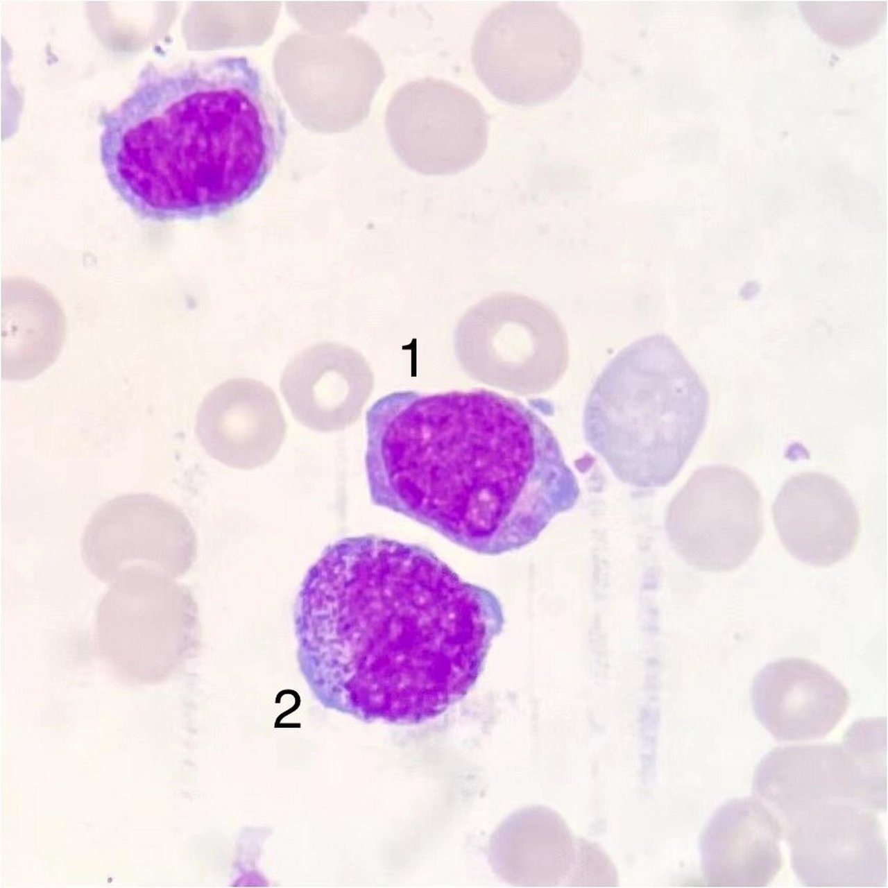 原始粒细胞图片大全图片