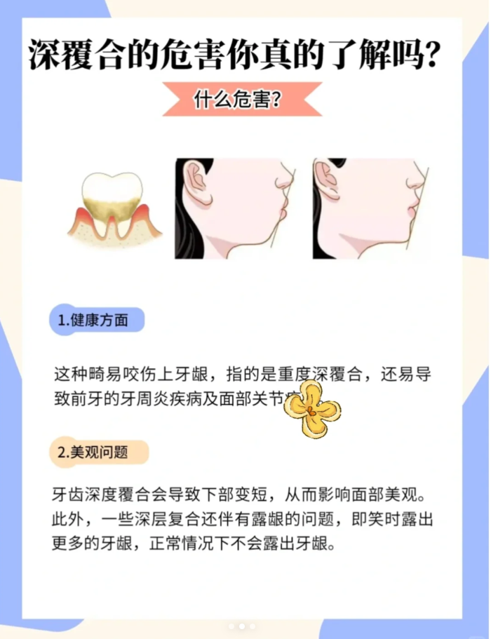 深覆合是一种上下颌牙弓(或)上下颌骨垂直向发育异常所致的错颌畸形.