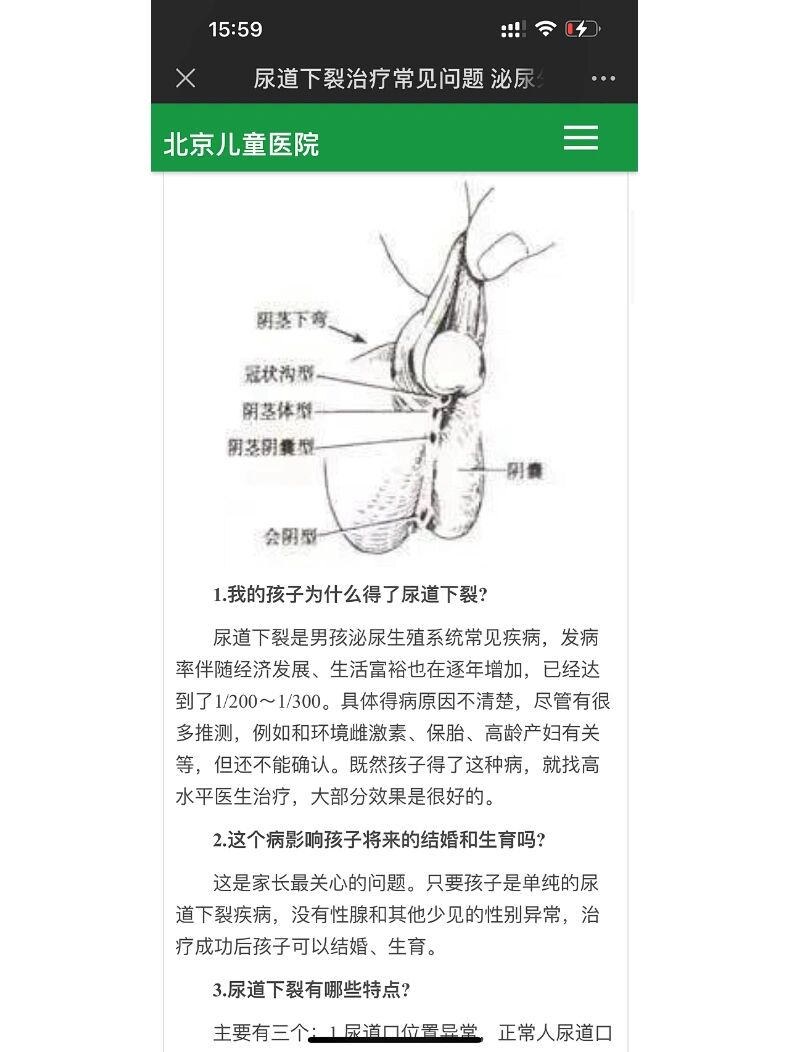 北京儿童医院尿道下裂科普1 图片内容摘自北京儿童医院官网