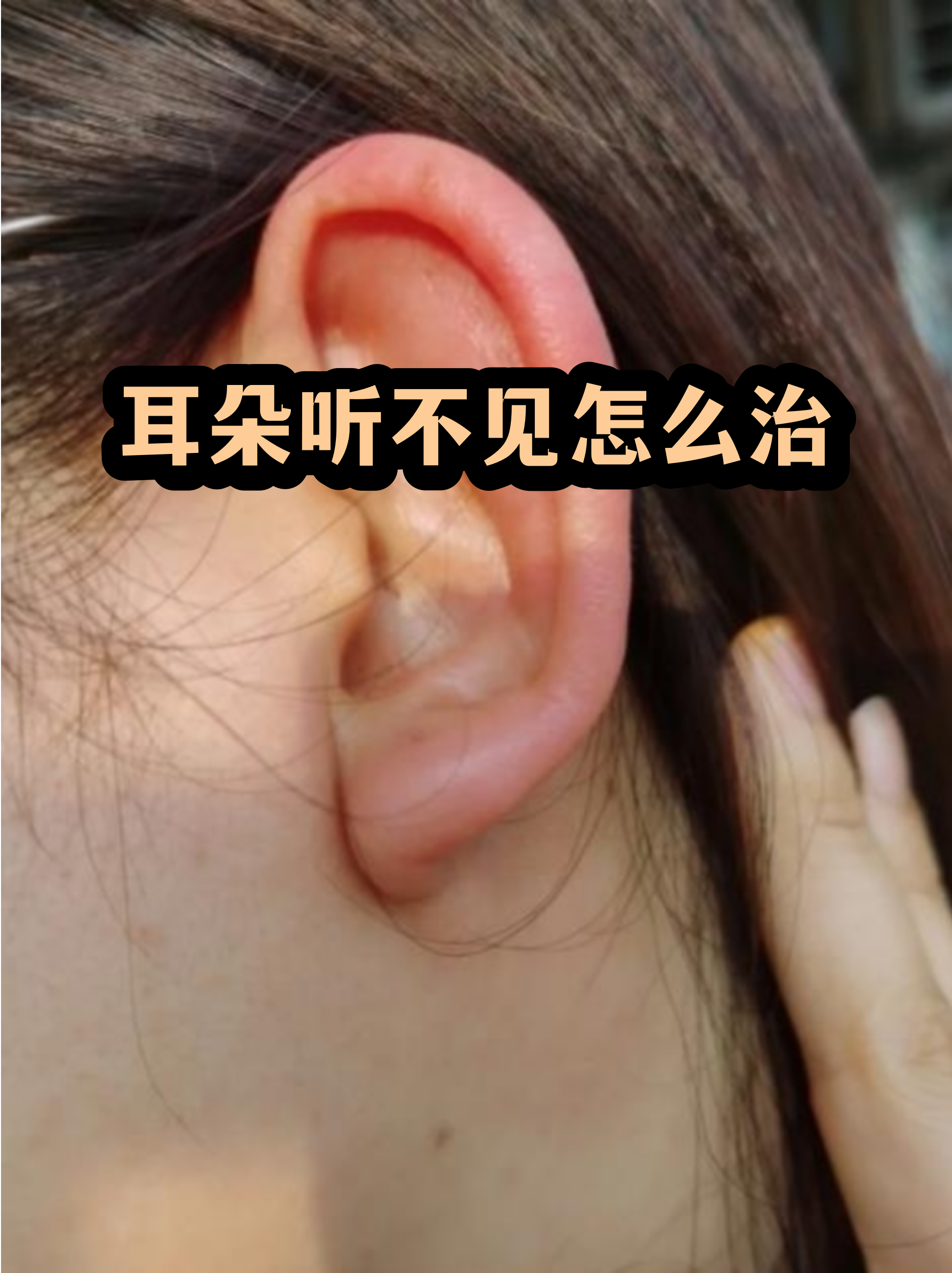 包含民航总医院代挂专家号服务复杂病情梳理,明确治疗方向的词条 包含民航总医院代挂专家号服务复杂病情梳理,明确治疗方向的词条