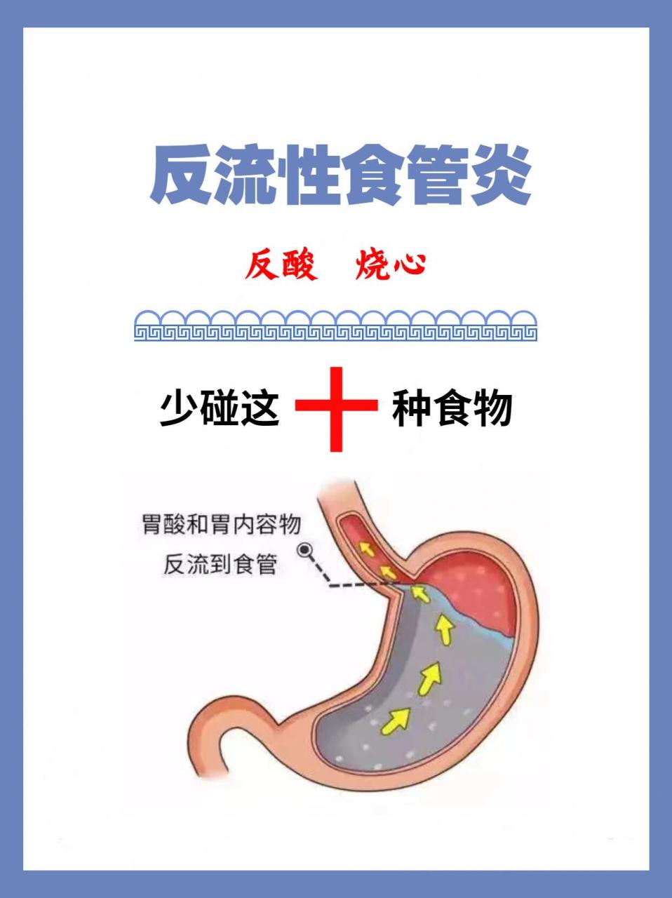 反流性食管炎这十种食物少吃,建议收藏6015 98反流性食管炎症状