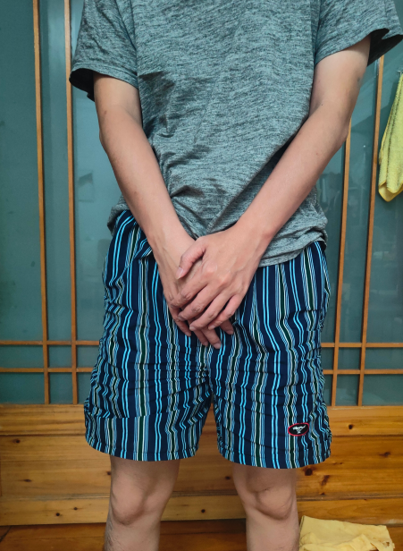 疼痛主要集中在会阴部,耻骨区,还会向腰背部和下腹部放射