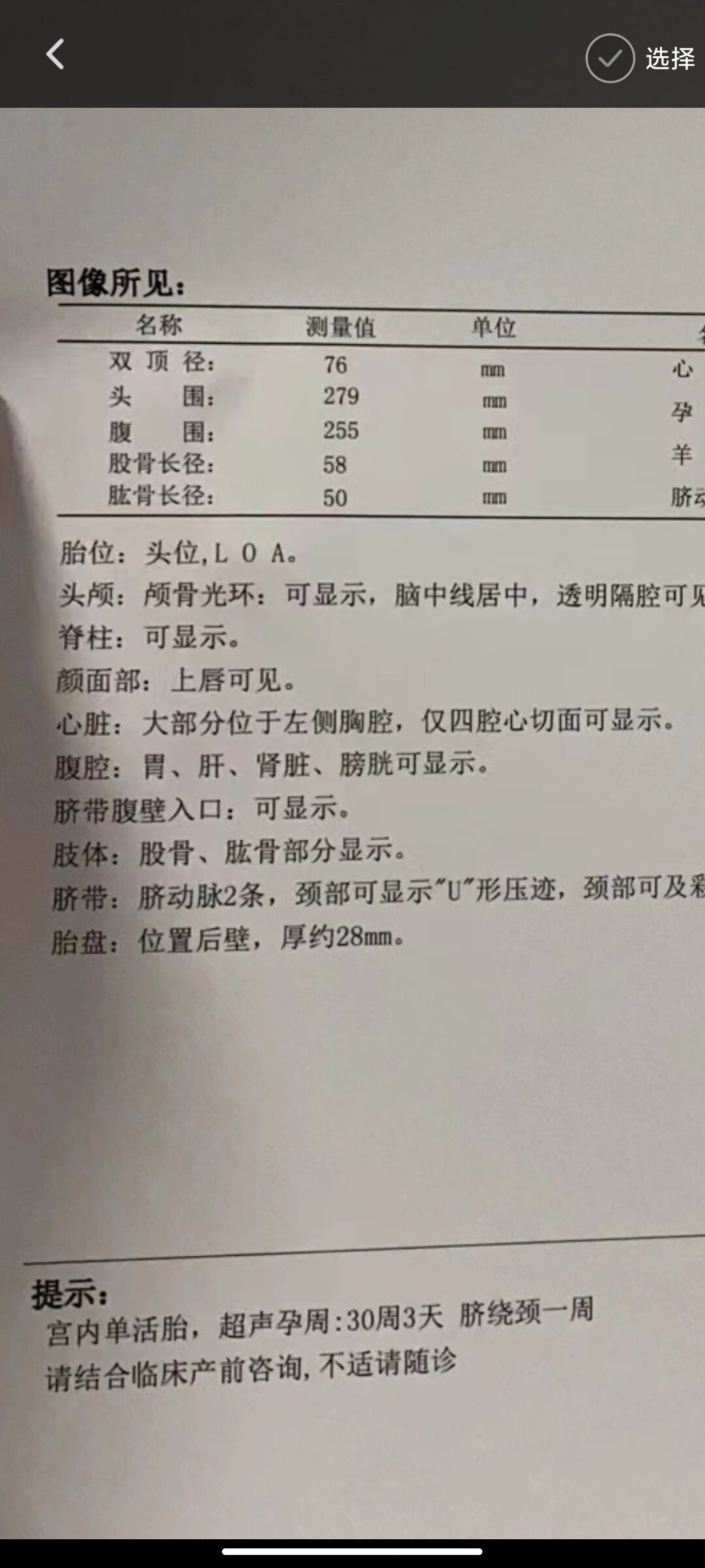 胎儿脊髓圆锥偏低,终于涨上去了 26周省妇幼做的,四维脊髓圆锥偏低
