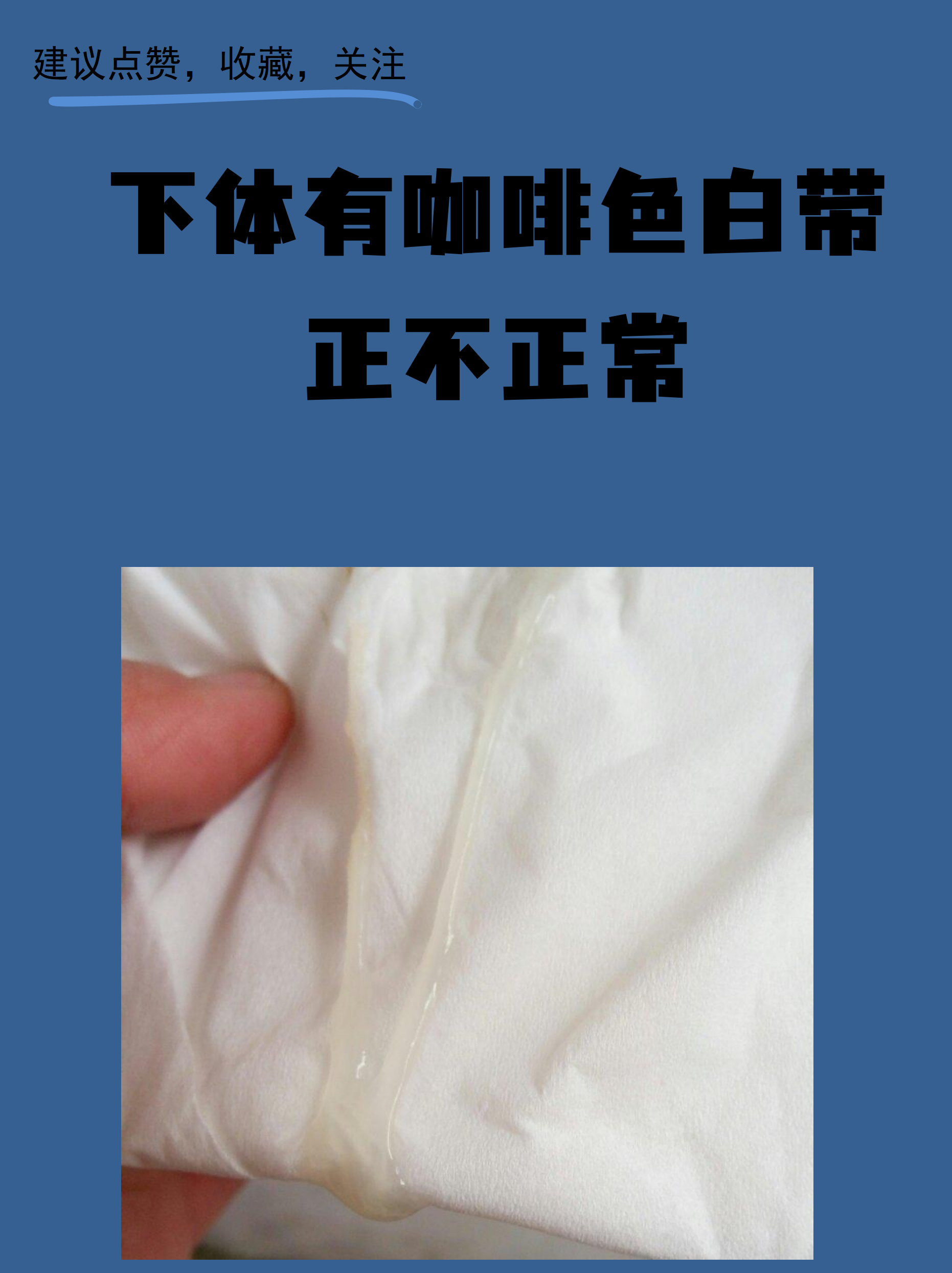 下体有咖啡色白带正不正常