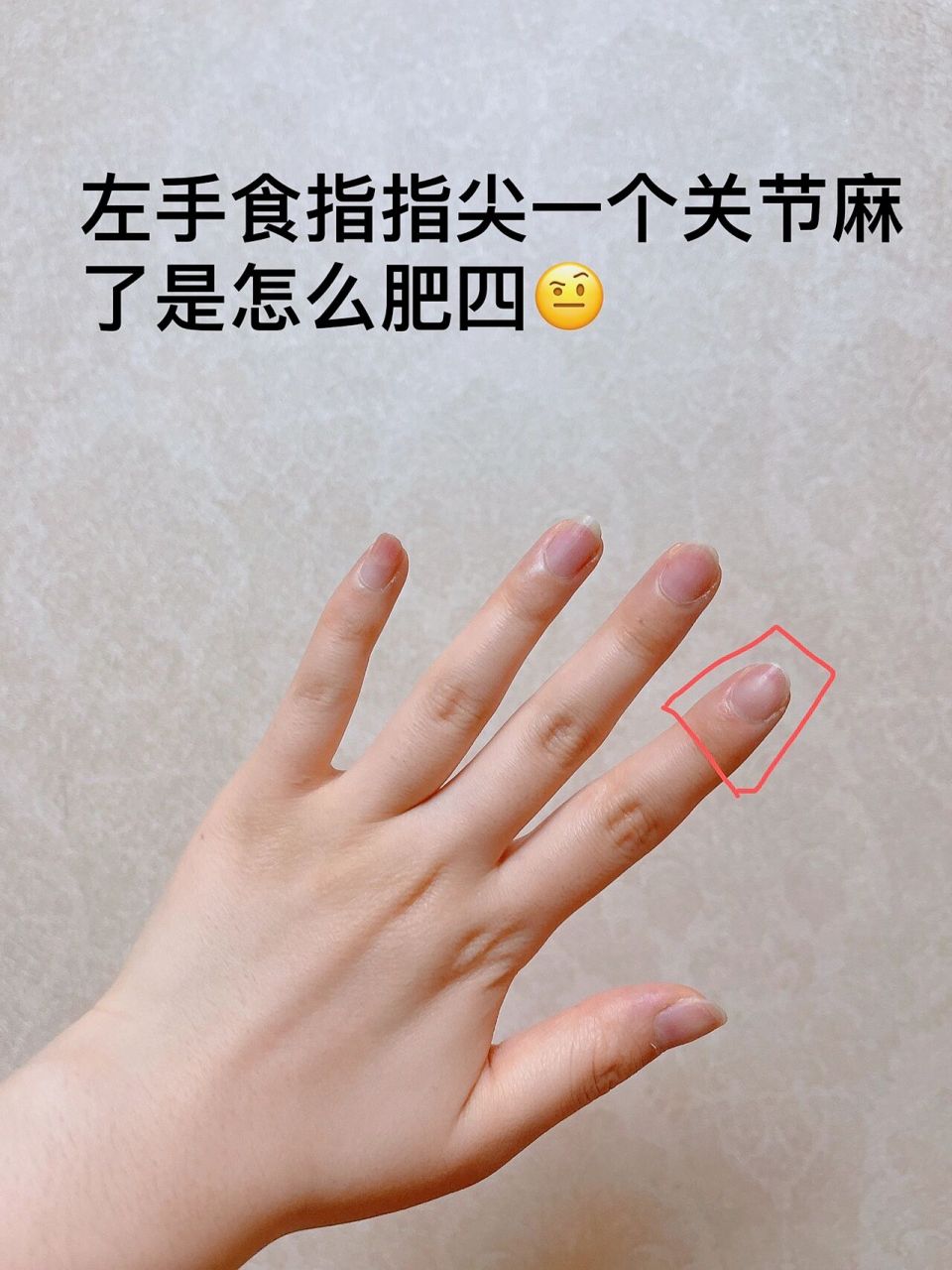 一觉醒来左手食指指尖麻了 今天凌晨两点多醒来上厕所觉得手指麻了