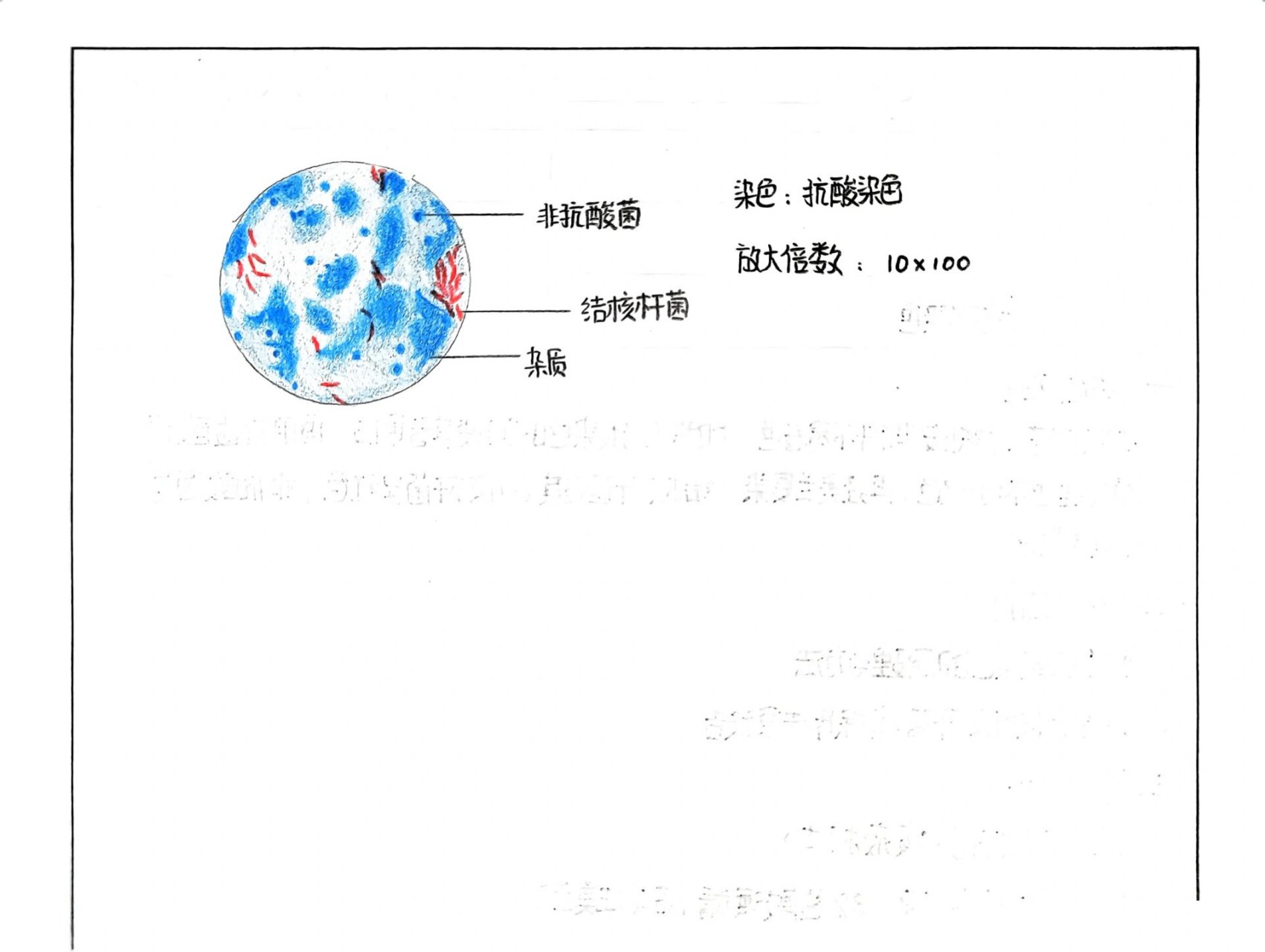 抗酸染色实验报告画图图片