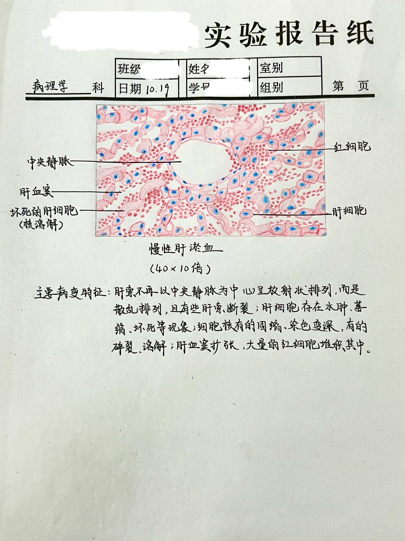 慢性肝淤血红蓝铅笔实验报告