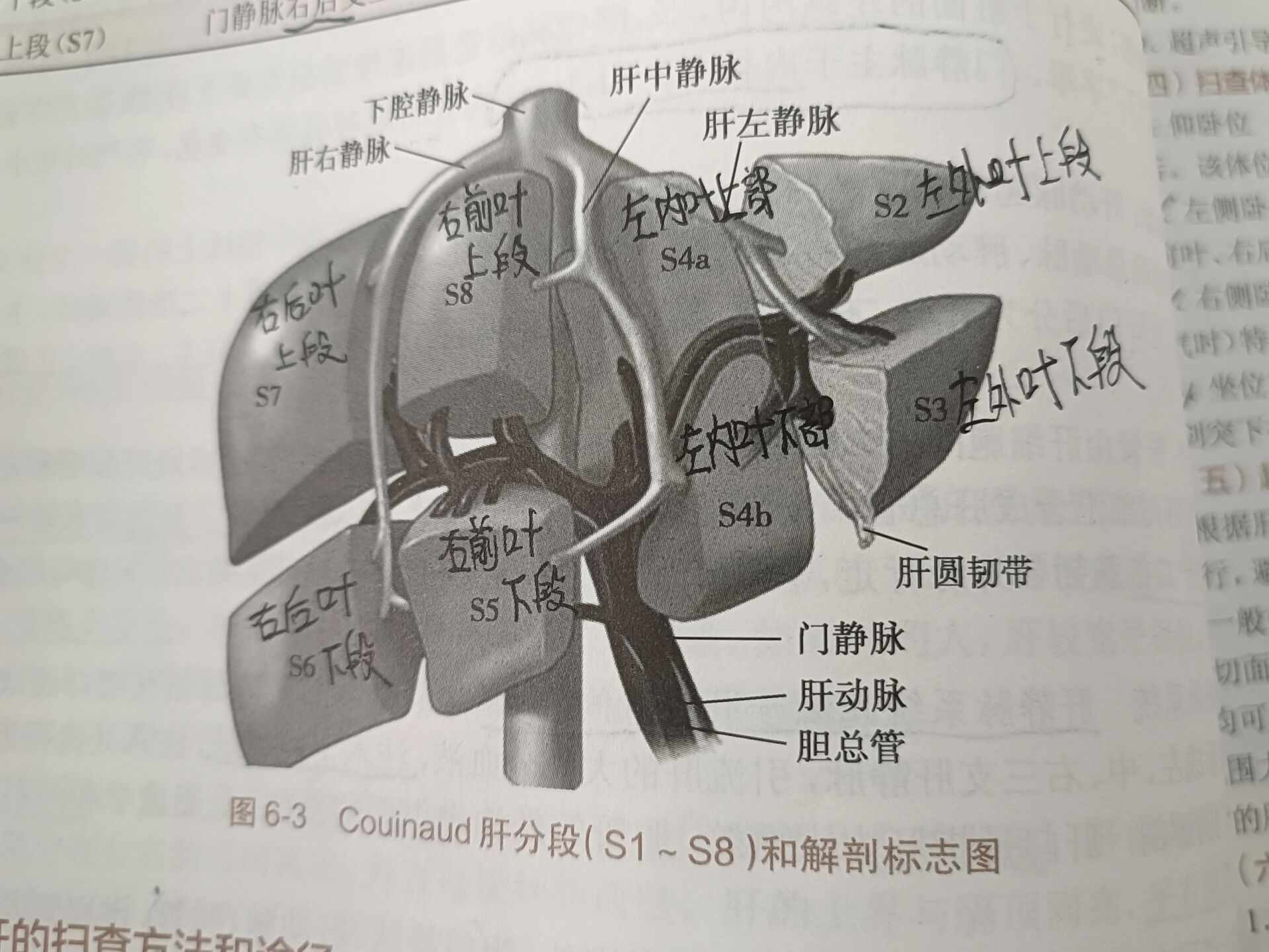 膈面脏面图片