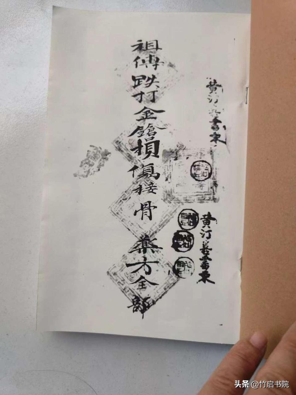 《祖传跌打损伤接骨秘方》清代名师【黄汀喜】秘传一册全 各种损伤穴