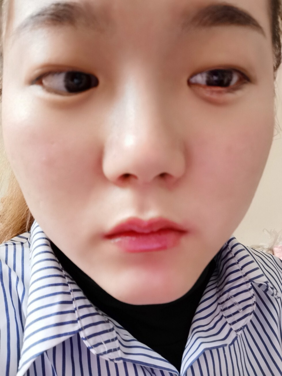 又长了眼疮 呜呜呜,火疖子才好,眼上又开始长麦粒肿,同事说是眼疮