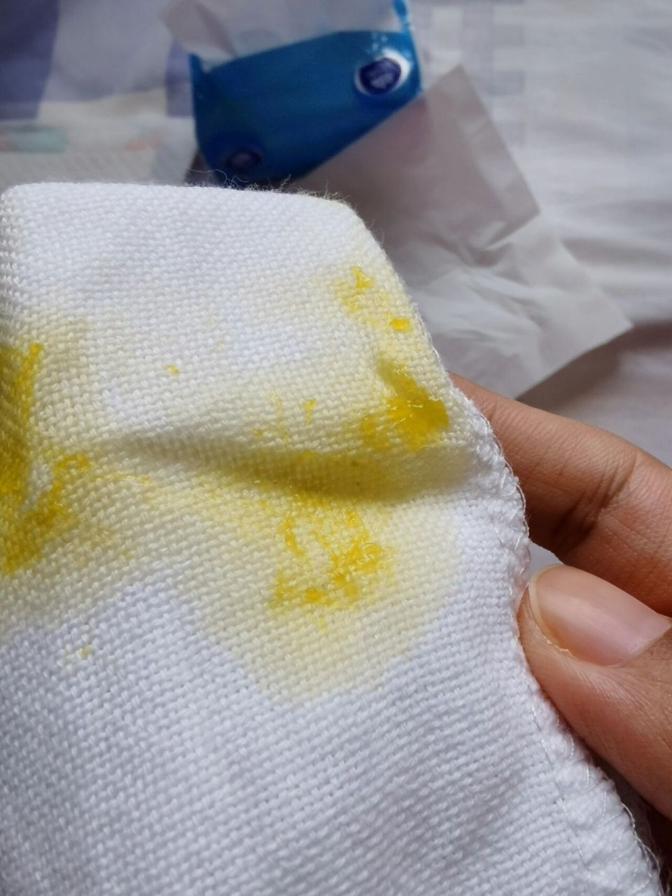 四月宝宝拉黄色透明果冻状黏便便,正常吗?