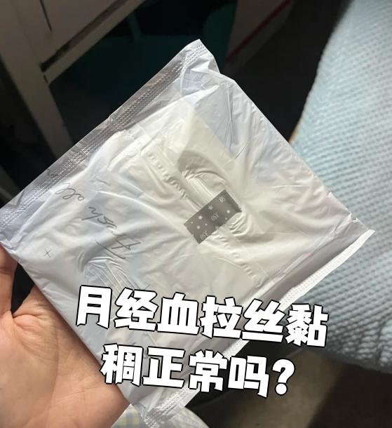 月经带一条条的血丝是怎么了_姨妈有一条的丝（经期有一条条的血带）