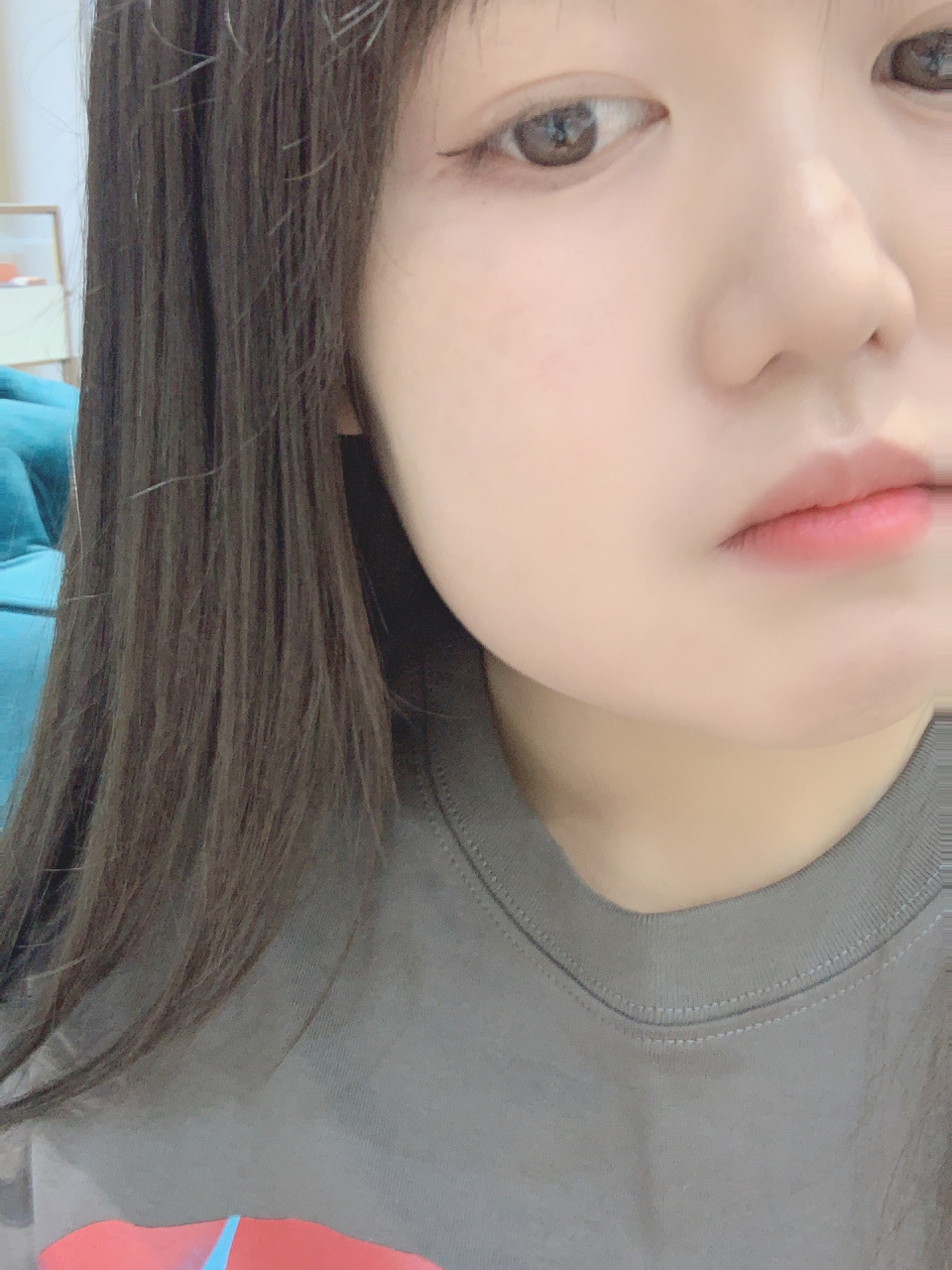 牙齿发炎脸肿了 脸肿的像包子一样,几年前做了根管治疗,现在又开始