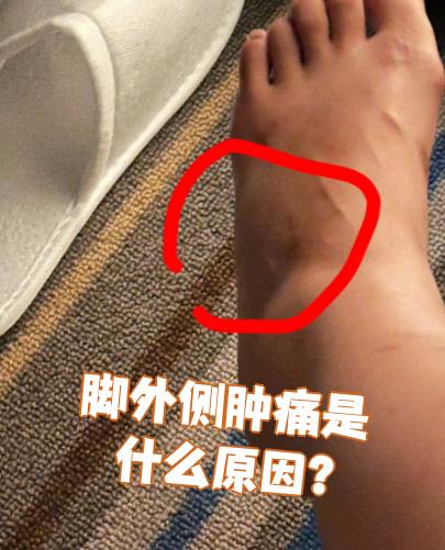 脚外侧肿痛常见原因包括生理性和病理性两类,具体需要结合症状表现