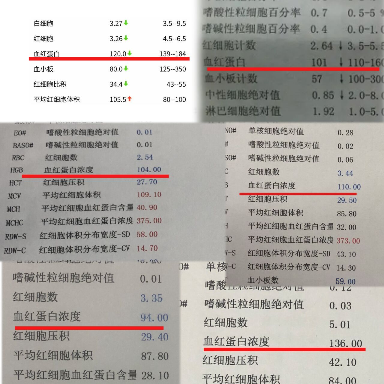 血红蛋白是红细胞内运输氧和运出二氧化碳的特殊蛋白质,血液呈荷