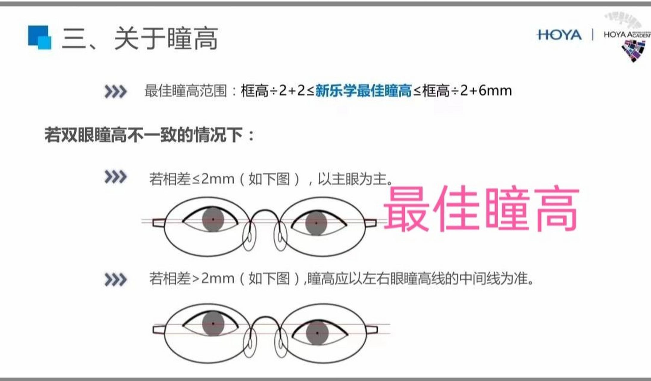 (欢迎点赞!互相关注) 量瞳高,点瞳!干货分享!