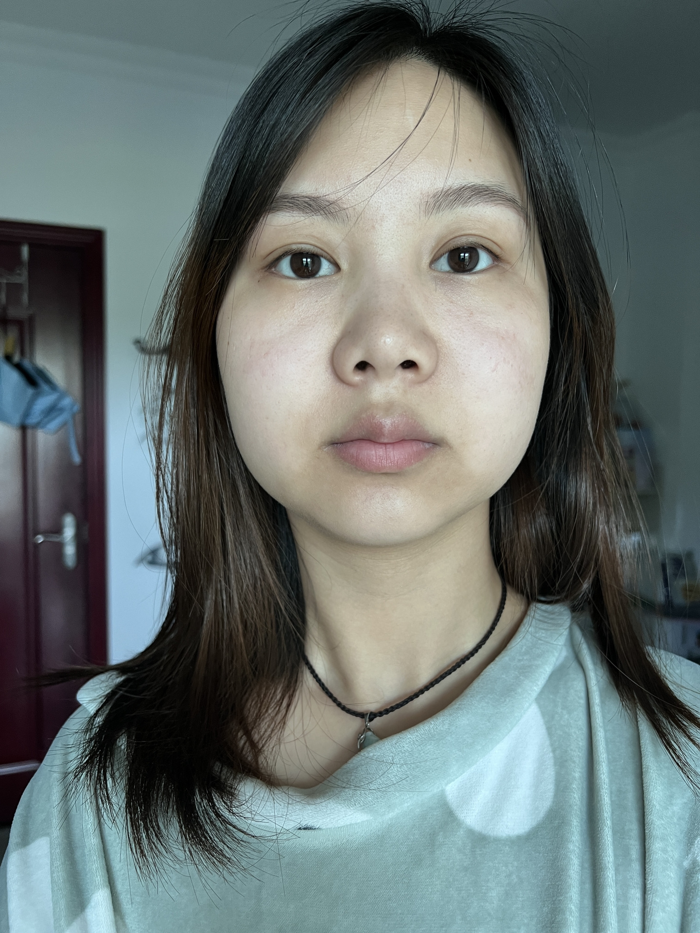 嘴巴周围的暗沉怎么可以去掉 好像从小就是发黄不均匀 也有中医说是