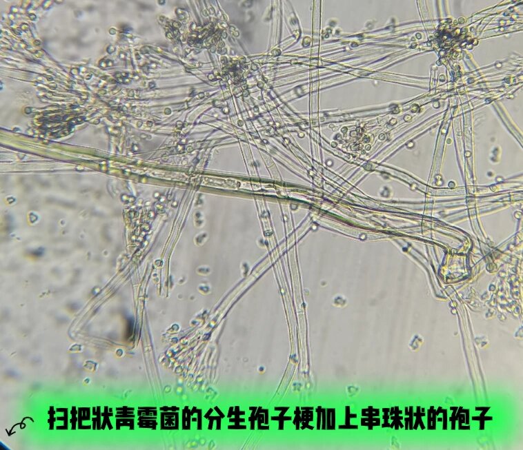 青霉的个体形态图图片