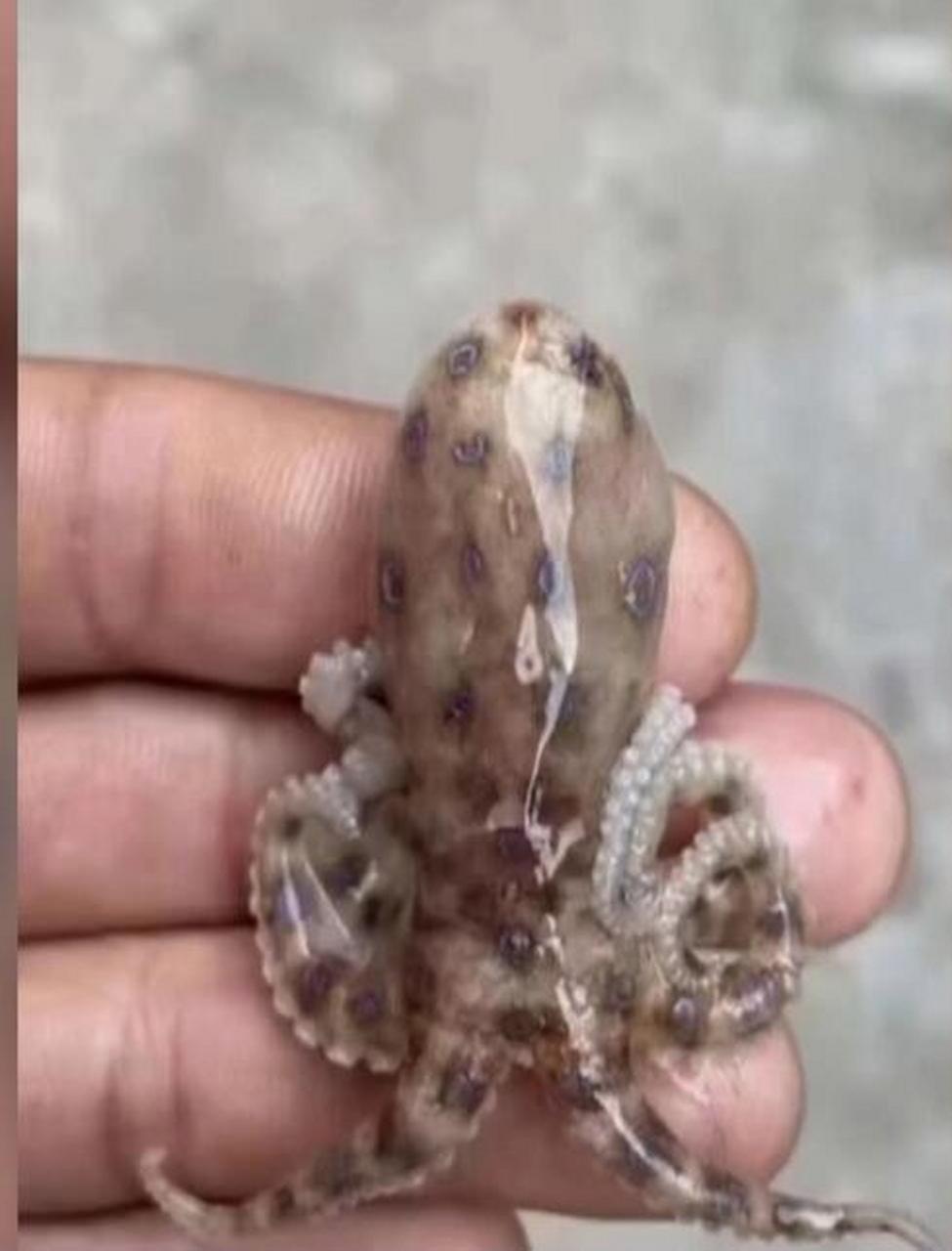 湛江 徐闻一女子误食蓝环章鱼被送进icu 目前仍在抢救中  4月10日,据