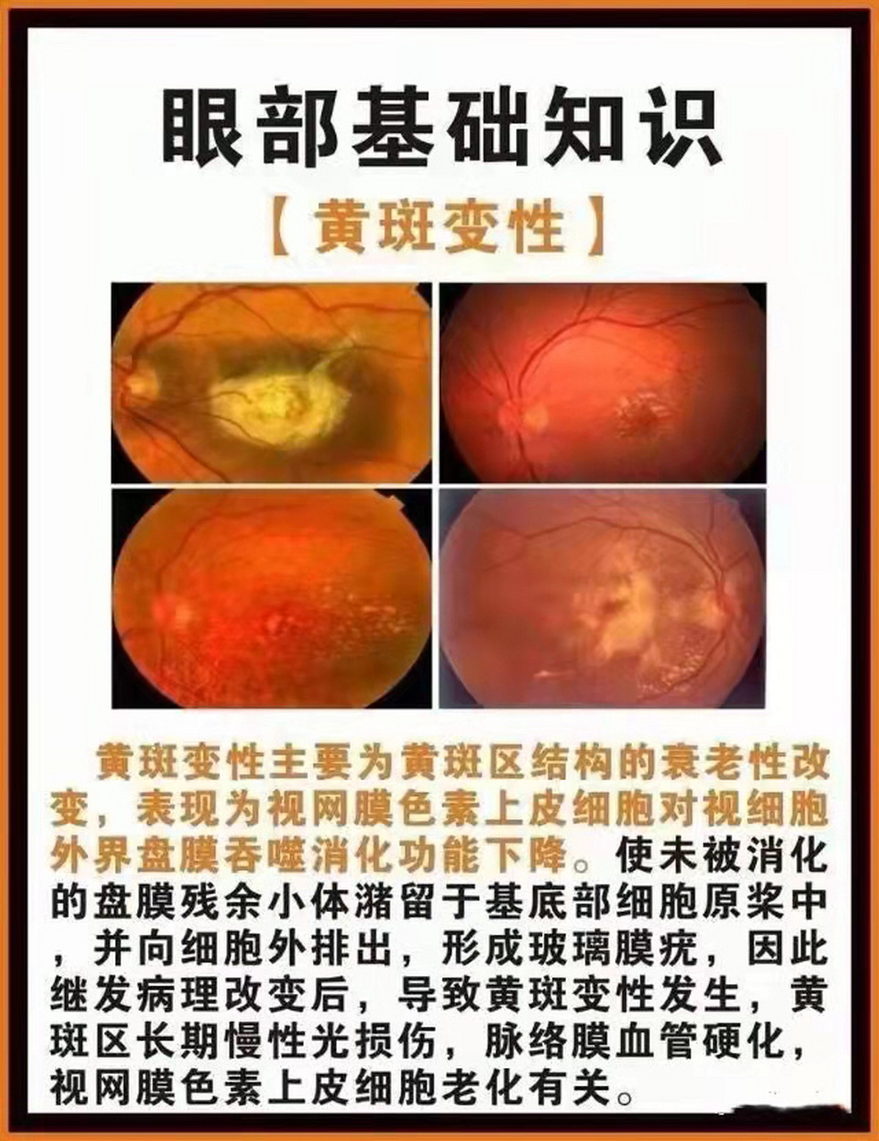 了解黄斑病变 黄斑病变多发于20～45岁青壮年.