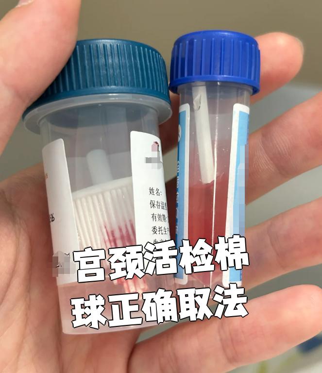 关于安定医院代取报告代挂号检查前准备事项提醒，一次顺利做完的信息