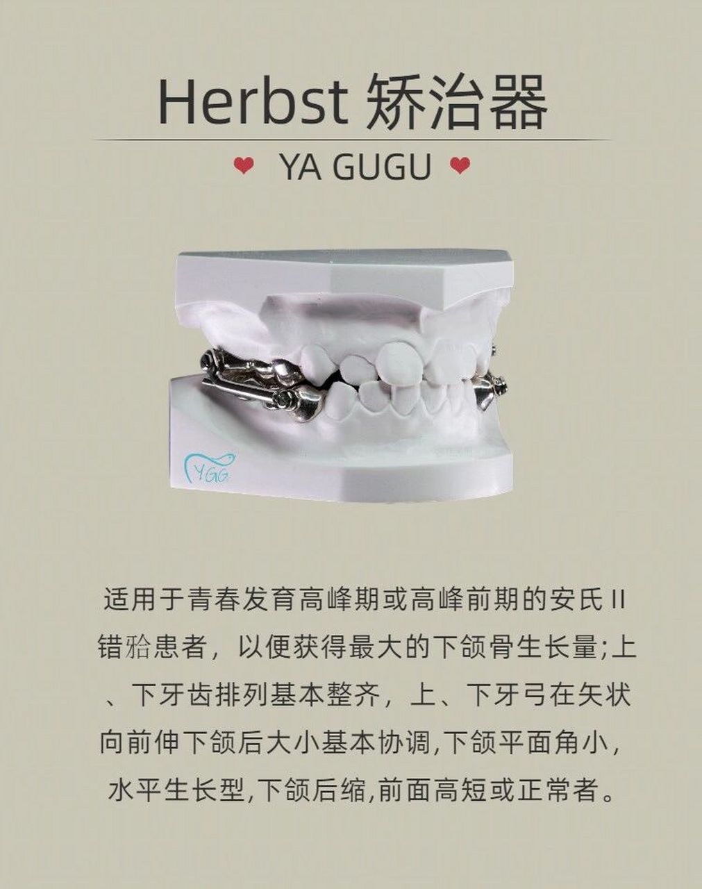今日学习:herbst矫治器 适用安氏二类错颌 herbst矫治器适应症和禁忌