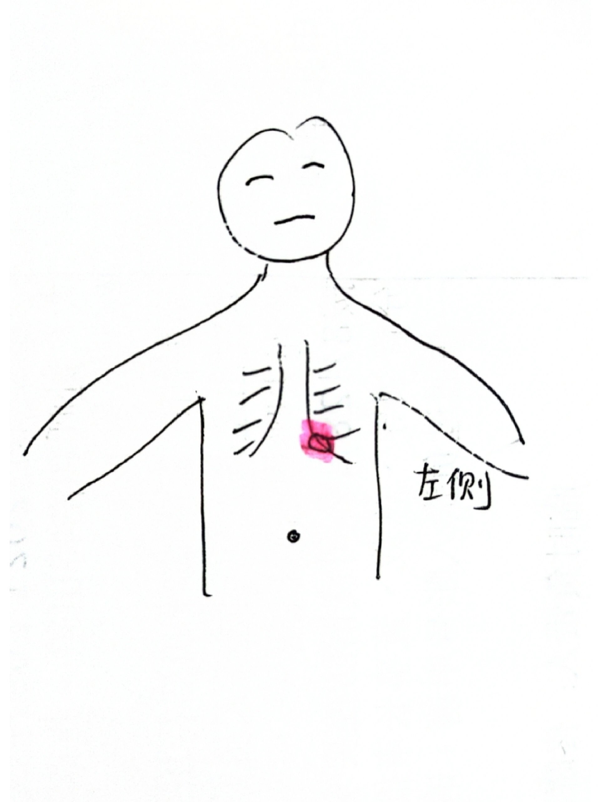 都是神医 深呼吸左侧肋骨边缘疼痛