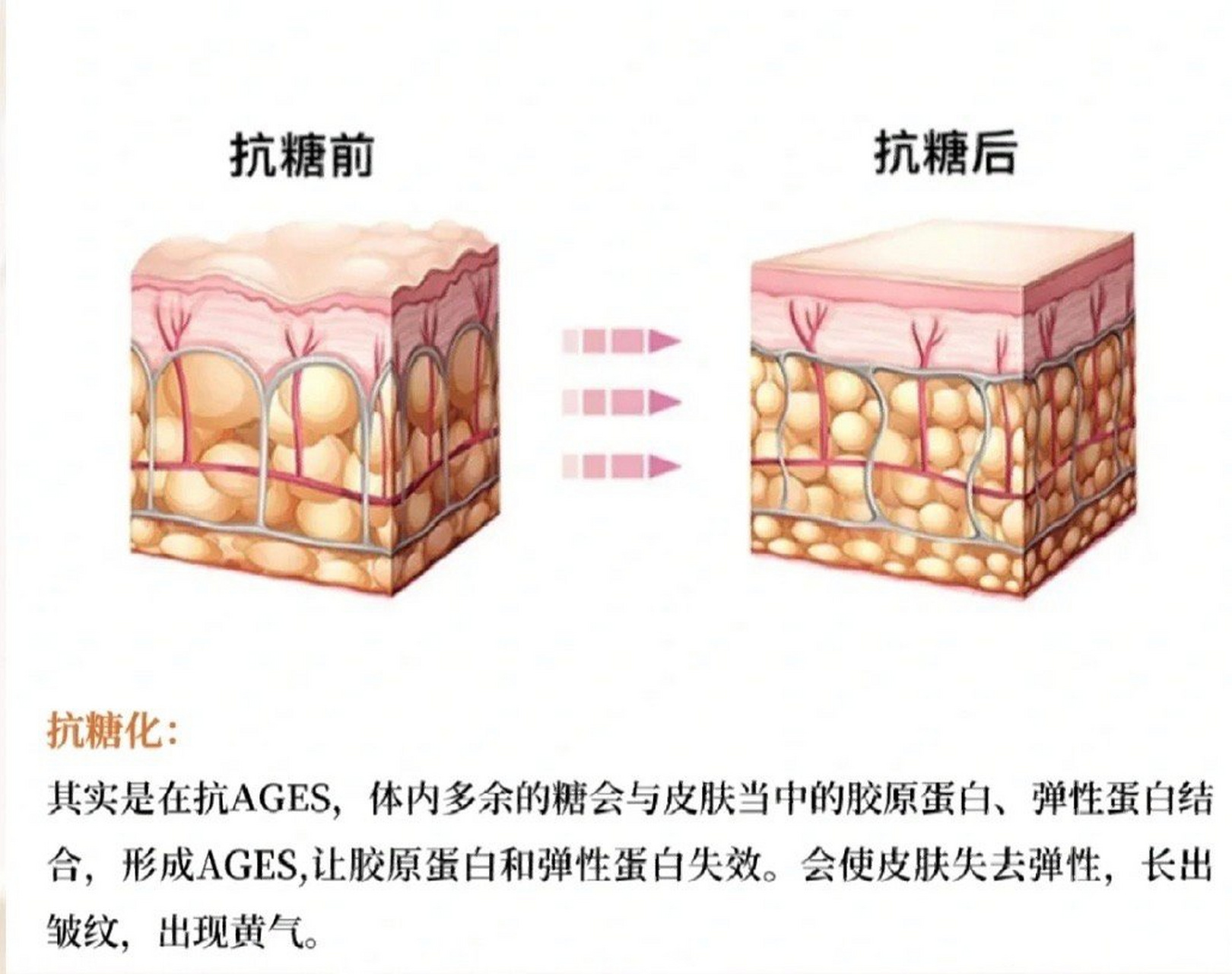 你被糖化脸拿捏了吗##这个问题吃什么# 抗糖不等于断糖,现在很多人都
