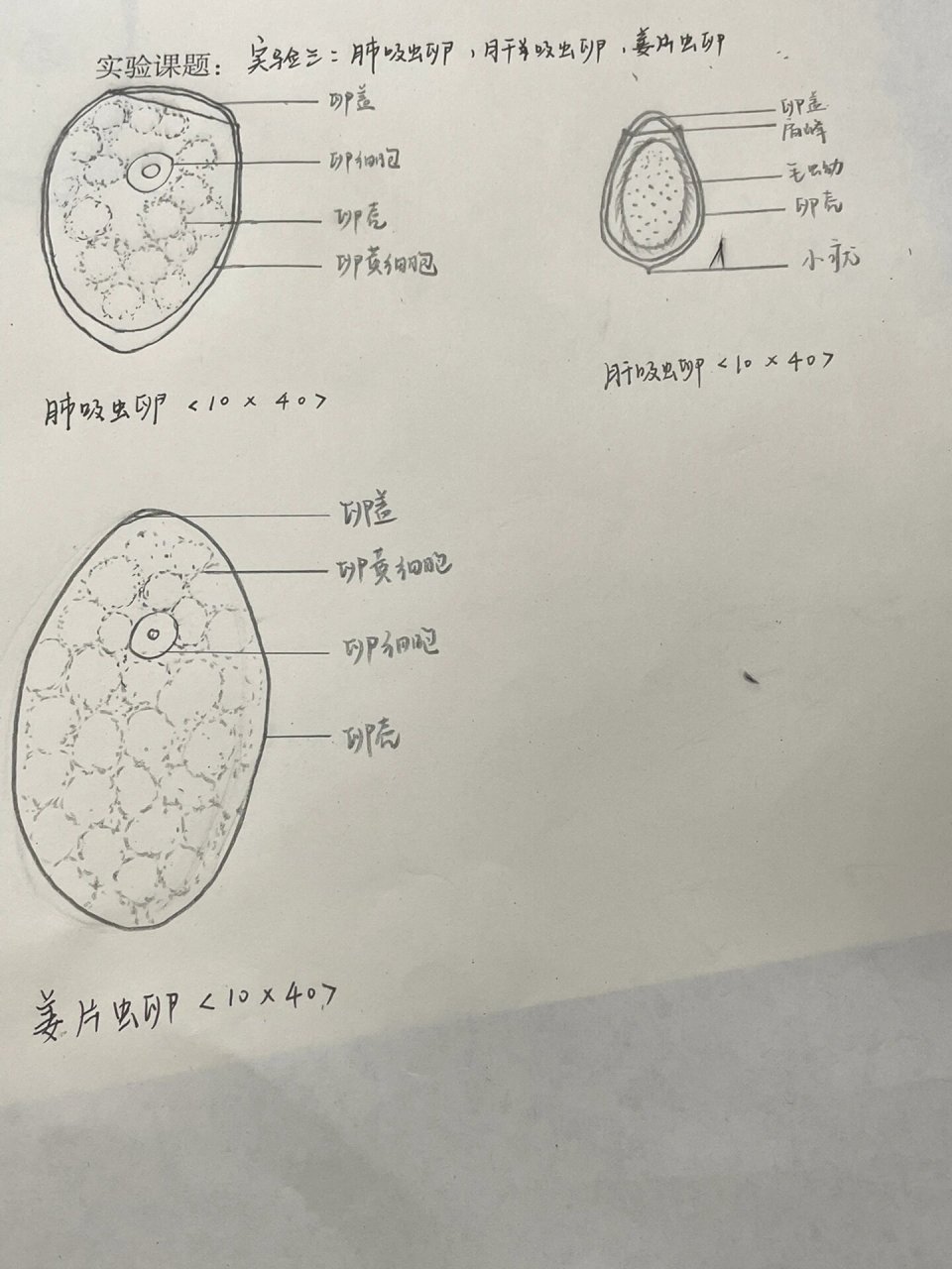 姜片吸虫卵结构图图片