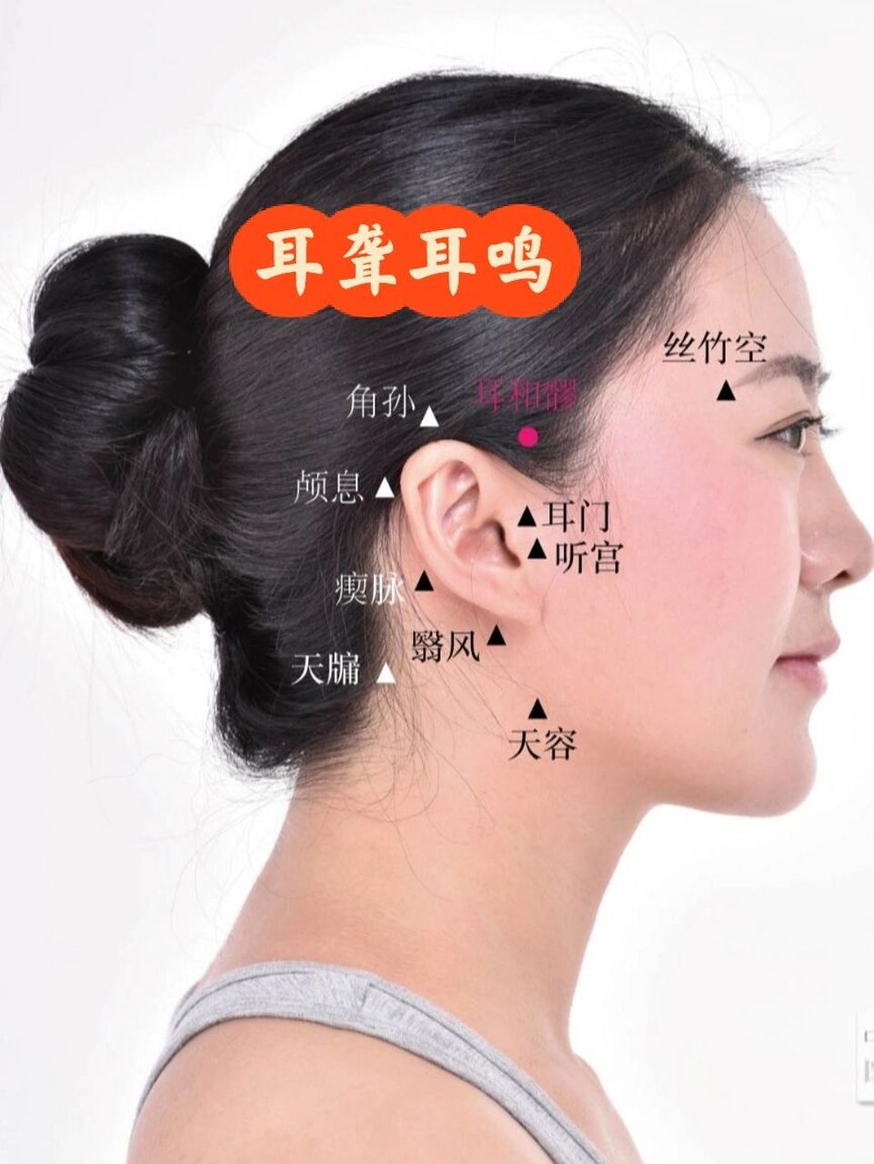 和髎,耳门,听会,听宫及翳风分布在耳朵周围,针刺一定要浅刺,没有经验