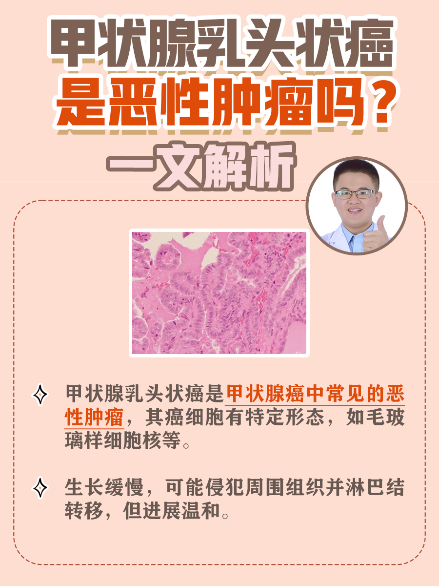 乳头状甲状腺癌图片