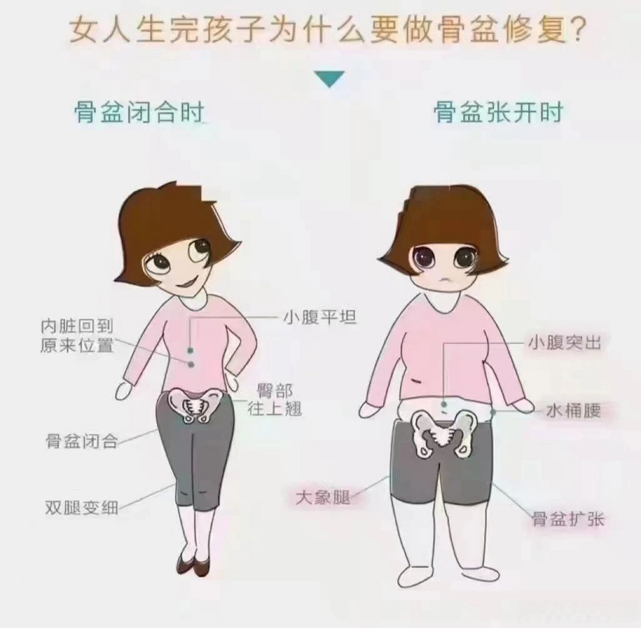 产后骨盆没有恢复好容易引起:  74腰痛,耻骨,臀部疼痛.