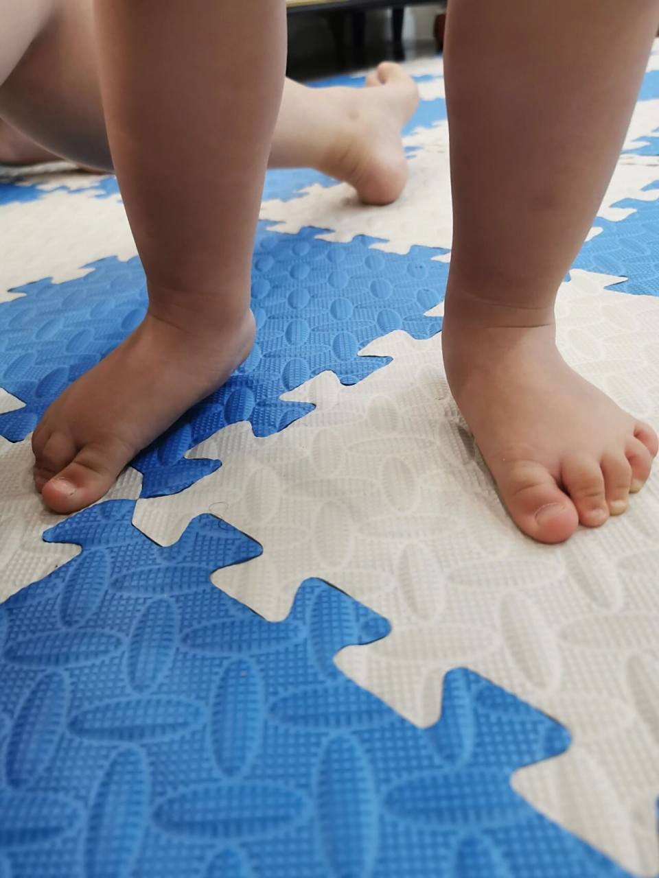 2岁足外翻严重吗?需要干预吗?