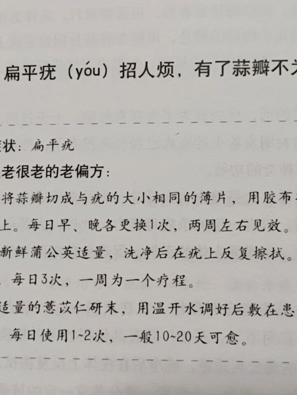蒜瓣治扁平疣 1将蒜瓣切成与疣大小相同的薄片,用胶布将蒜片固定在疣