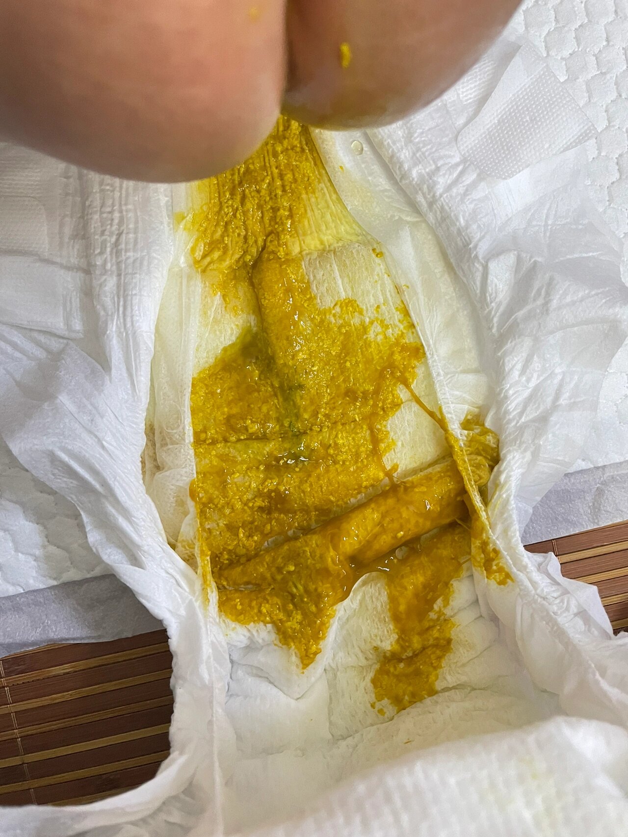 感冒咳嗽吃了抗生素后拉肚子 上个星期开始宝宝因为被