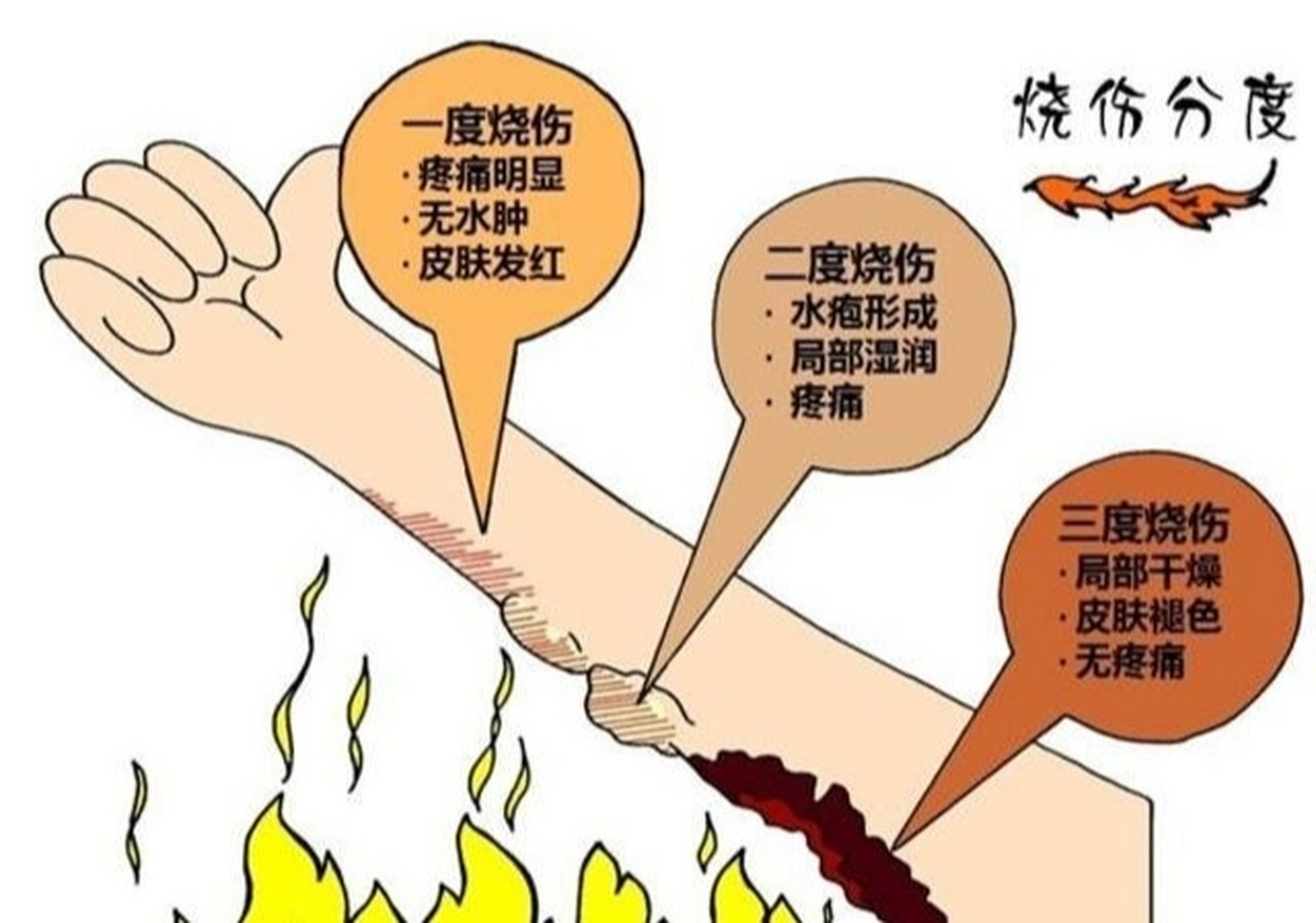 有烫伤疤痕的人一定要注意这5点 95959595959595 066