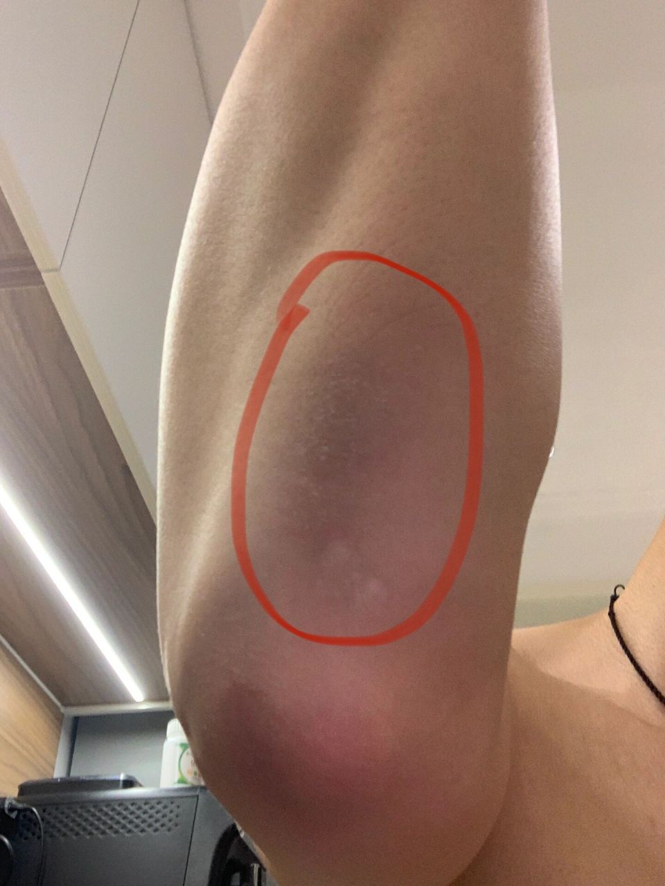 这个天气胳膊肘上还有一块皮肤干燥发黑,又不是上课久坐