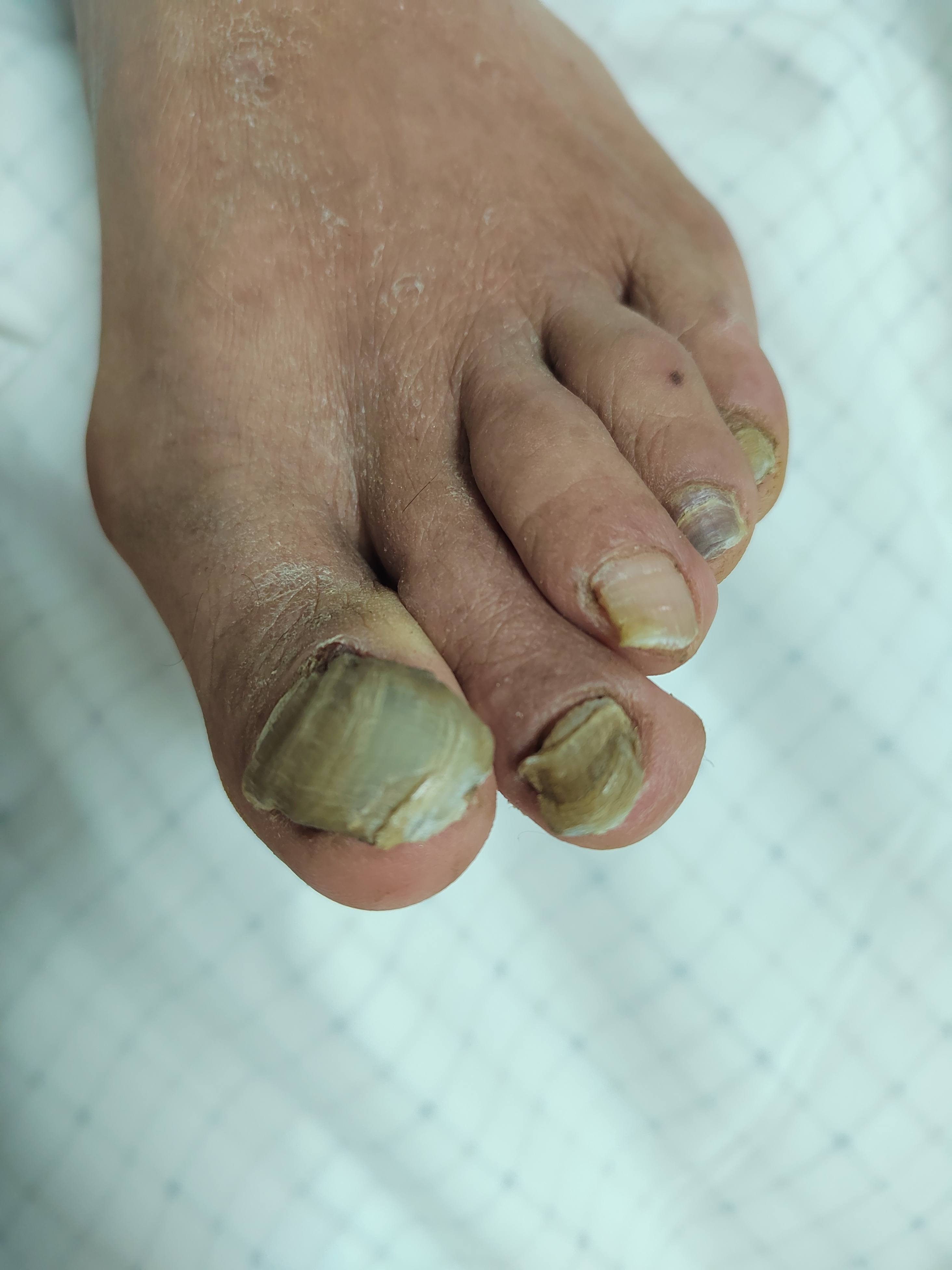 纪秀军皮肤科主任医师的动态