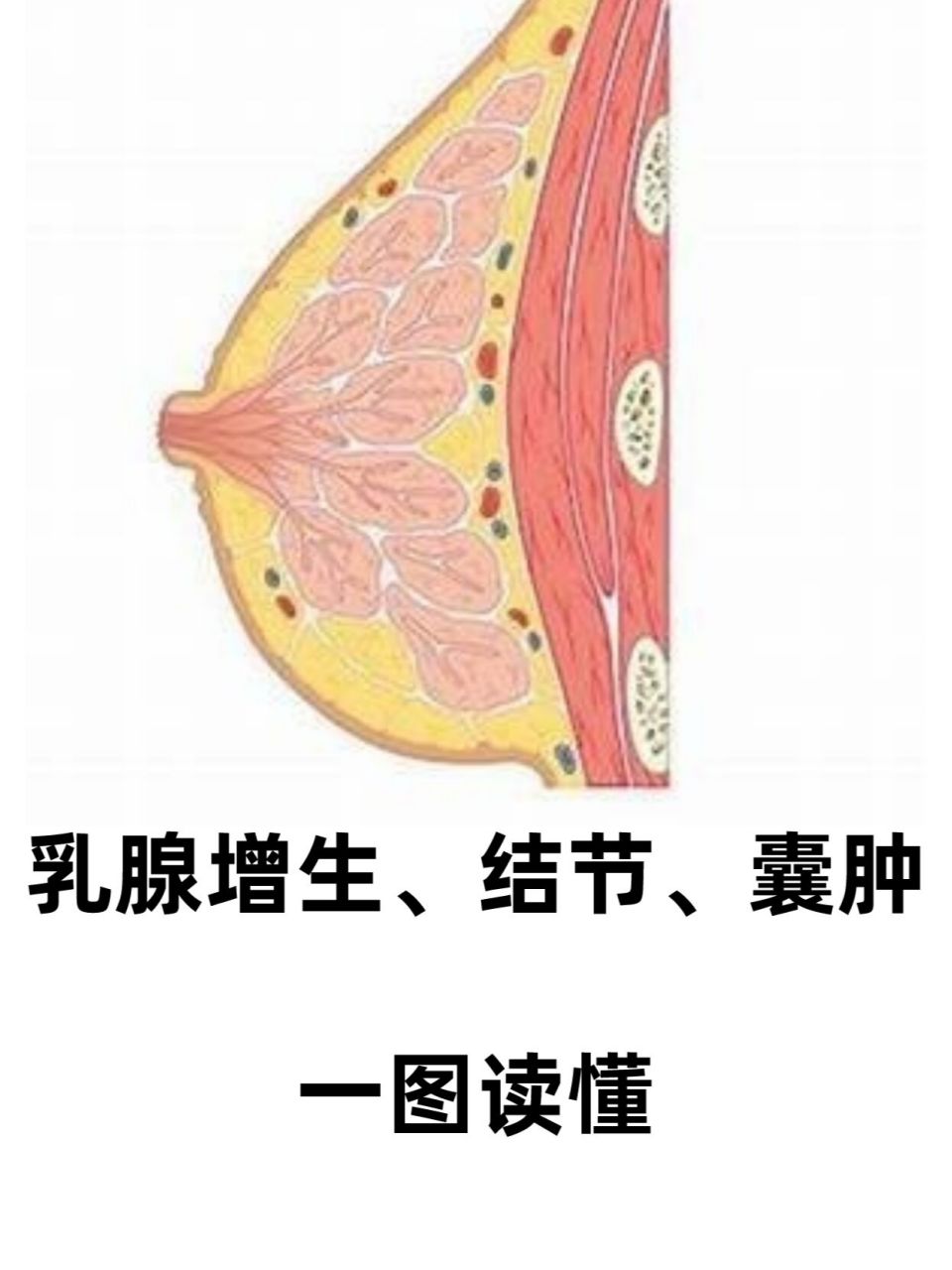 乳腺增生,结节,囊肿|一图读懂 大部分都是良性,不要害怕担心.