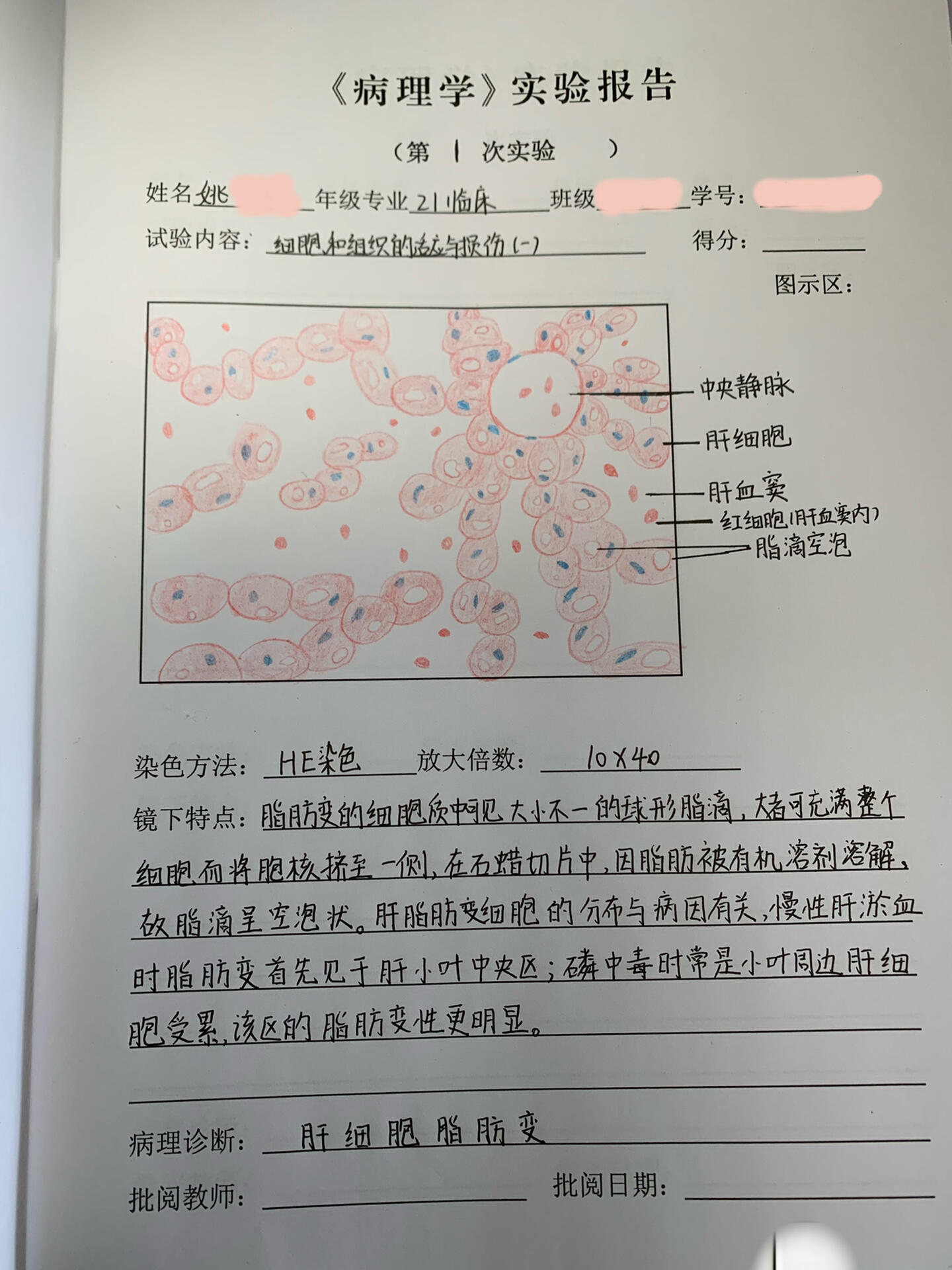 病理学实验报告一 肝细胞脂肪变