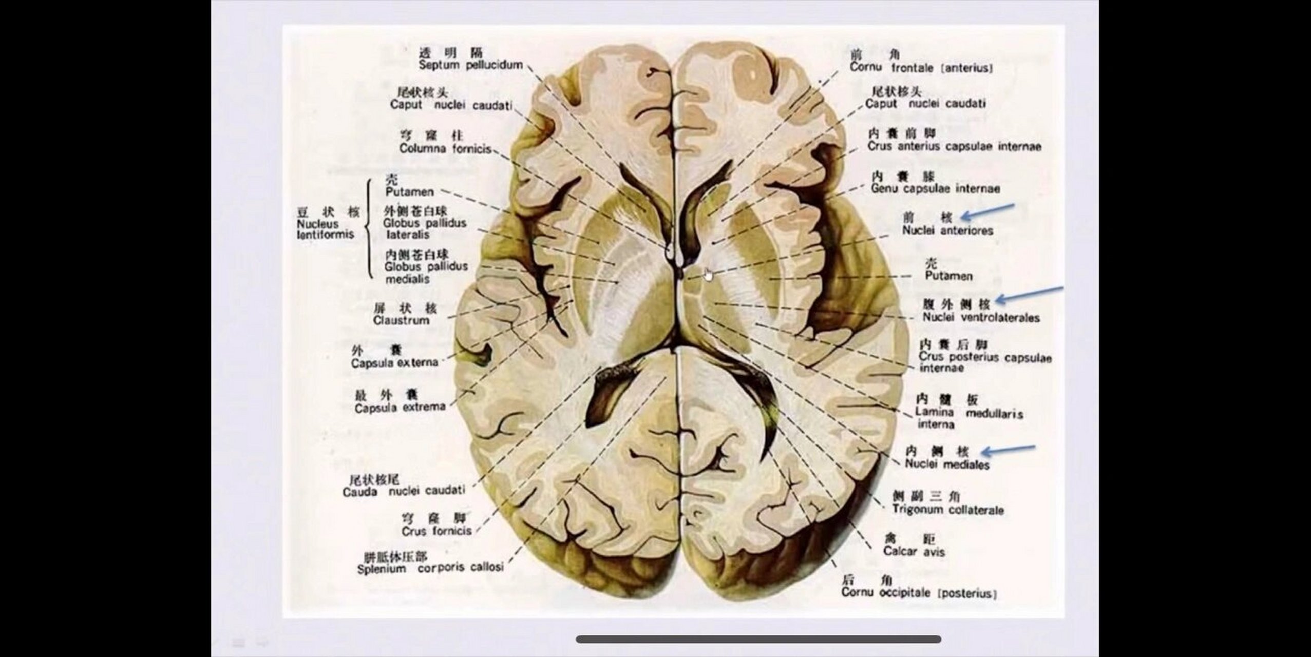 大脑基底节区的解剖08 基底节又称基底核,位于近大脑半球底部的白质