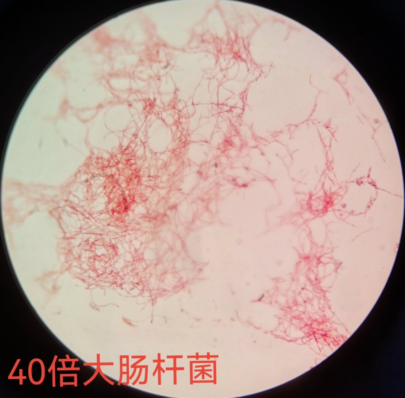 炭疽杆菌100倍油镜图片图片