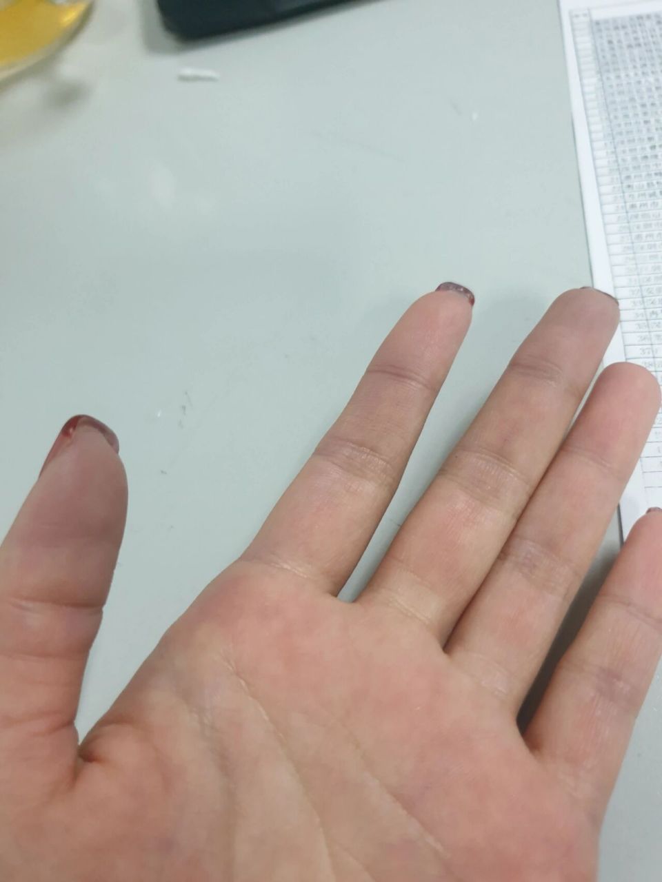 好担心,最近手指指尖会泛紫 说是冷到的,但是我穿的很厚,是不是身体出