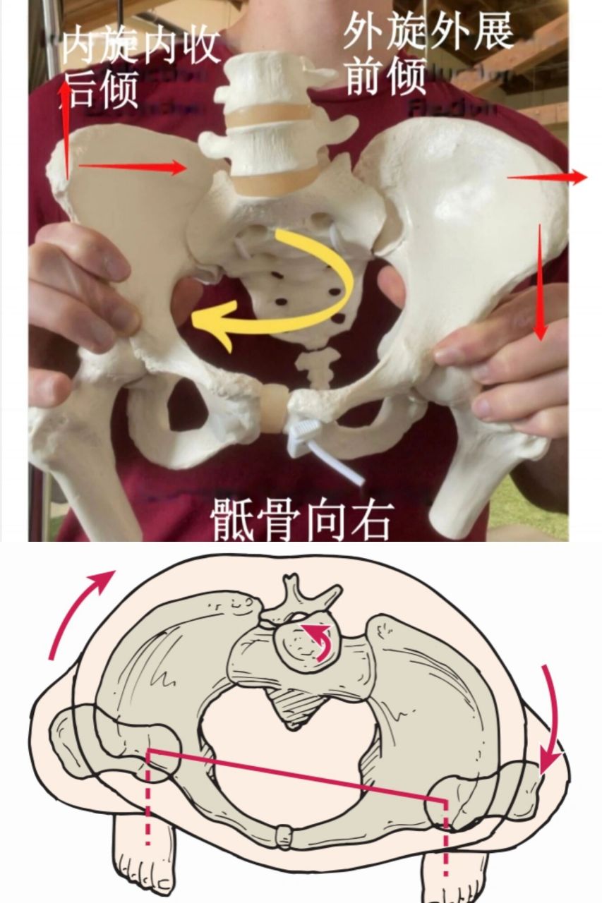 骨盆后倾的症状图片图片