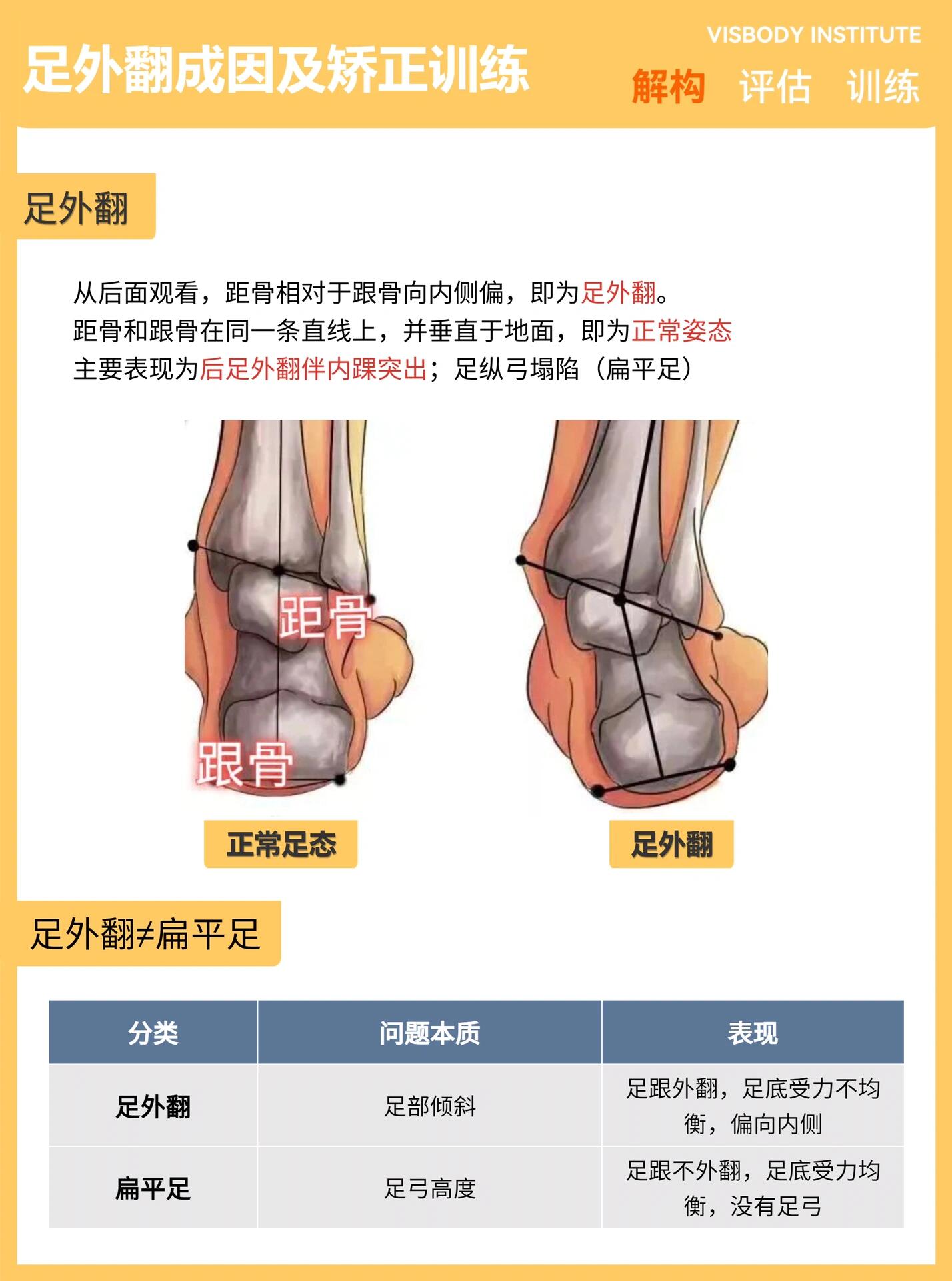 足内翻图解图片